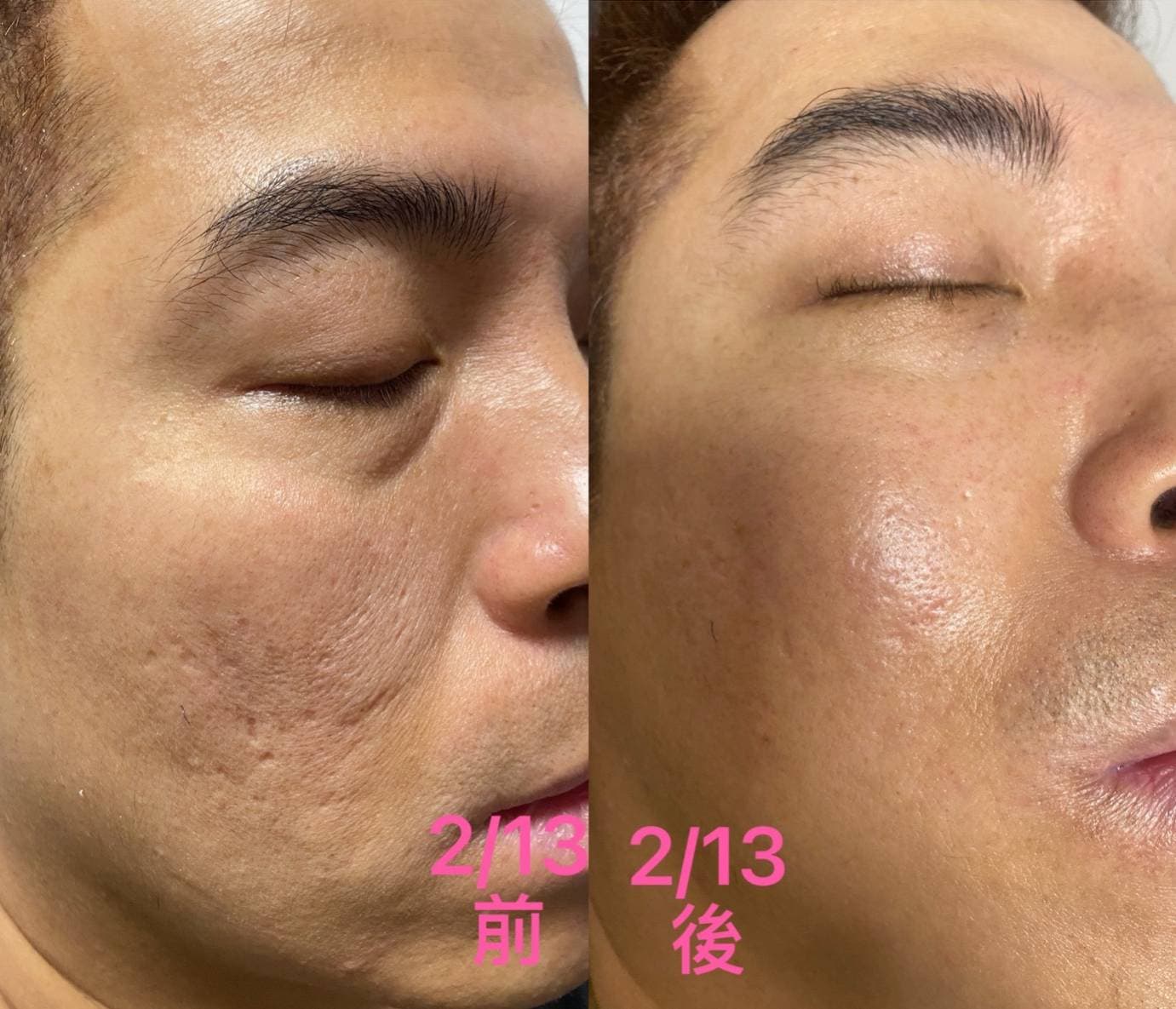 使用前後